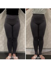 ジュノ(JUNO)/Before After