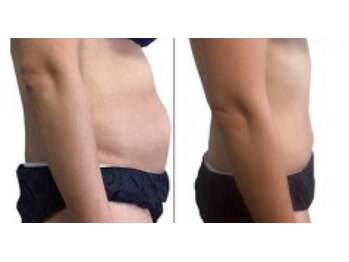 アリス 赤坂/８カップ10回　計８０カップ