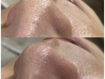 ミオワックス(MIOWAX)/鼻の気になるざらつきも◎