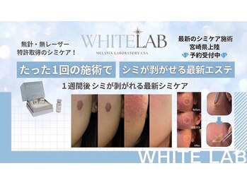 レディースサロン ノザキ(NOZAKI)の写真/シミ改善☆宮崎初☆ホワイトラボ導入！1回の施術で剥がせる感動体験を♪