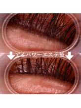 ラフィーユ うるま店(Lafille)/アイパワーエステで洗浄も