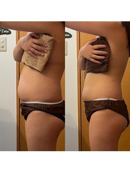 ヨサパーク カプア 立川本店(YOSA PARK Kapua)/ぽっこりお腹がなくなった！