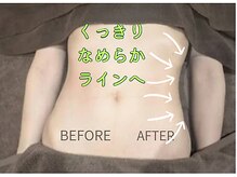 アッファシナンテ(Affascinante)/施術：オリジナル深筋骨メソッド