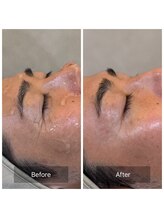 ビーケア 麻布十番(B-care)/【マイオリフト】