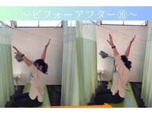 ケアるら整骨院 富里院/ビフォーアフター