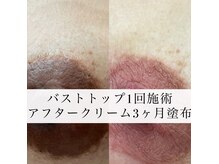 ジュノプラス 諫早店(JUNO+)の雰囲気(【ローマピンク】長崎初導入!1回の施術でベビーピンクに♪)