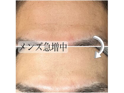 リンク(LiNK)の写真