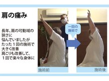 セルフケア整体 新宿店/実際のお客様◆1来店　肩こり