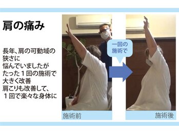 セルフケア整体 新宿店/実際のお客様◆1来店 肩こり