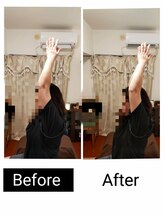 アース エンジェル整体院/ビフォアフ　肩こり　ストレッチ