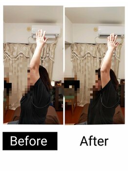 アース エンジェル整体院/ビフォアフ　肩こり　ストレッチ