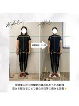 ラクリエ 東加古川院(La Creer)/お客様ビフォーアフター