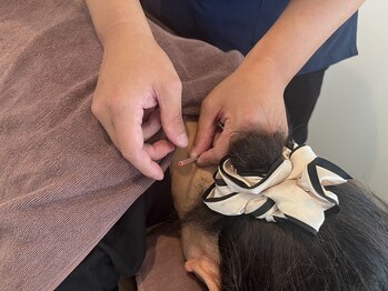 トゥービー(TWO-B)/頑固な首肩こり撃退！！