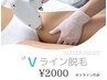 女性限定【Vライン脱毛】