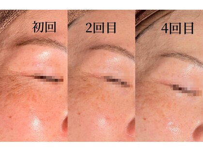 サロン ド エム(salon de m)の写真
