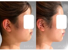 ソナ 大和西大寺院(SONA)/お顔の横幅をぎゅっと小さく！