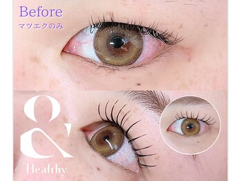 ザ ベッピン(the 別嬪)/重たいまぶたの方もパッチリ目に