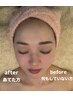 《初回限定》顔のもたつきが気になる方に　温感フェイシャル体験60分 ¥4,980