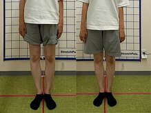 やまかわ整体院/隠す脚から魅せる脚へ。O脚矯正