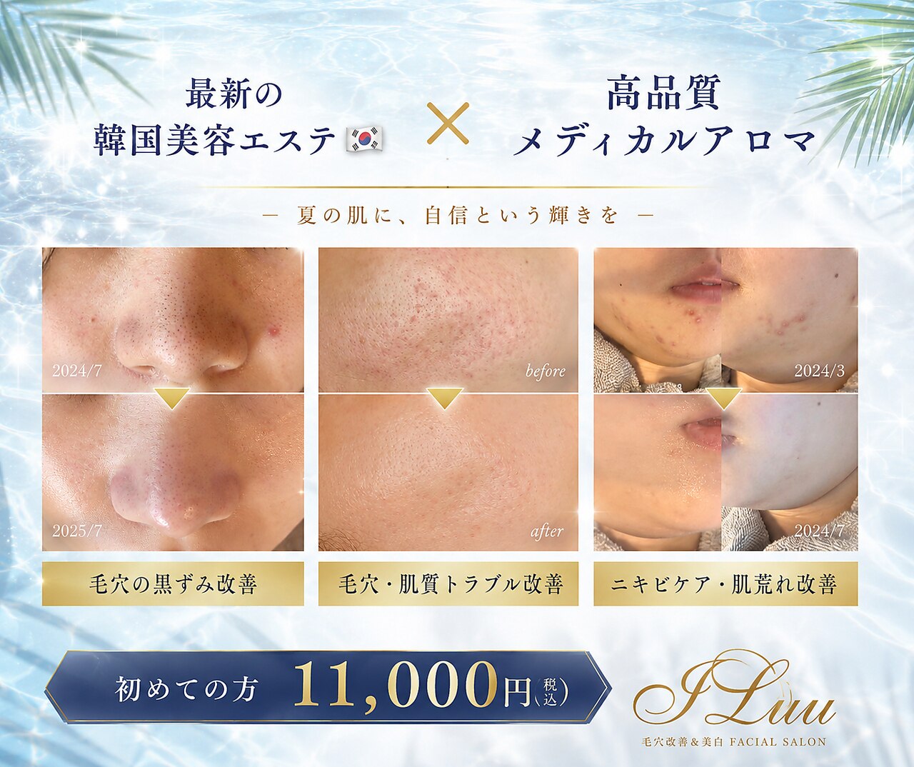 新潟市南区でフェイシャルエステが人気のエステサロン｜ホットペッパー