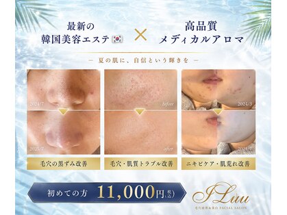 イルー(ILuu)の写真