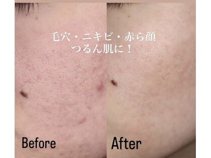 イリゼ(IRISE)の写真