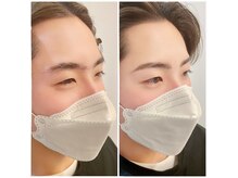 モアビューティ 本通り店(MORE BEAUTY)の雰囲気(丁寧なカウンセリングで、あなたに最適な施術をご提案します)