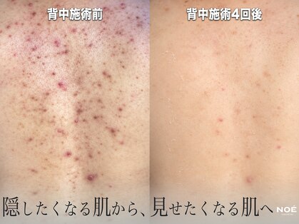 ノエ 新宿(NOE)の写真
