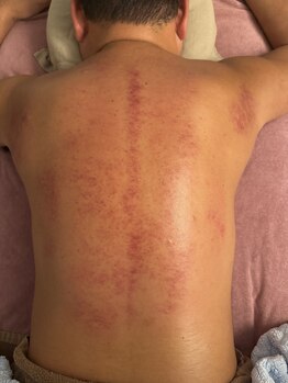 ホスピー(Hosppy)/カッサで身体スッキリ☆