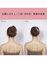 リュクス(Luxe+TKM HANATEN)/小顔コルギ