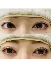 アイヨンマルゴ 西梅田店(EYE405)/マスカラパーマ