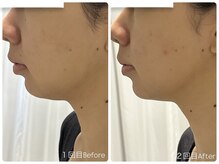 ラグ(LUXU)/レモンボトル，モニター様♪