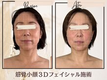 アンリール(Anrire)