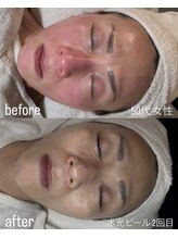 フロル(FLOR)/FLOR【根本改善専門店】