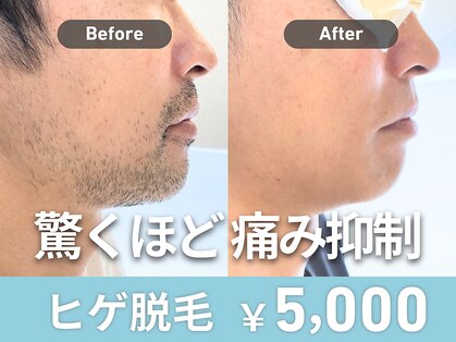 ユング 渋谷店(YUNG)の写真