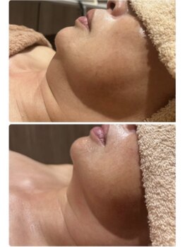 ソラ(sola*)/レモンボトル