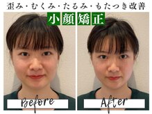 リモド(Rimodo509)