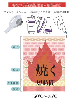 ヘルディン(heldin +555)/老化を促進させるNG高温施術