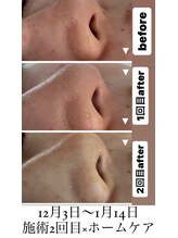 キュアリード(Cure_Lead)/セルマンケア♪