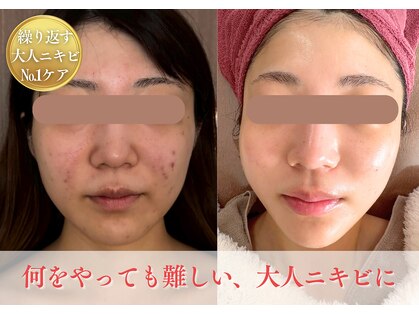 ルルドフォンテ(rurudo fonte.)の写真