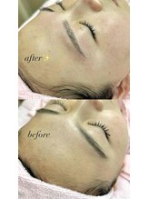 ビューティフェイス ビューティアイラッシュ 岡山天満屋店(BeautyFace Beautyeyelash)/お顔剃りと眉WAX同時◎【岡山】