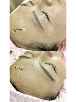 ビューティフェイス ビューティアイラッシュ 岡山天満屋店(BeautyFace Beautyeyelash)/お顔剃りと眉WAX同時◎【岡山】