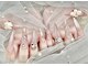 ミラクルネイル(Miracle Nail)の写真