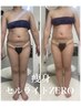 【20・30代本気の全身痩身】温め×解し×流しの3層ケアでスッキリ美ボディ