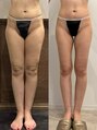 パリスヒロトン(PARIS HIROTON) お客様に合わせて組み合わせできる痩身クーポンがオススメ♪