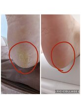 遊歩堂/かかと外側