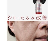 ビューティーサロン セガール(segar)の雰囲気（「レッドショット」使用で美肌＆小顔に）