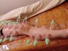 【足の疲労感・むくみ足・冷え足に◎】足背面カッピングですっきり♪