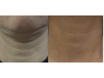 シールーム ヴィ エスポワール(Croom vie espoir)/首には年齢が出てしまう