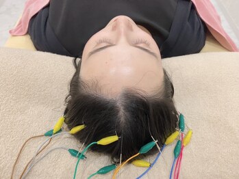 ハリシア(HARICIA)/鍼ヘッドスパ(頭皮鍼)